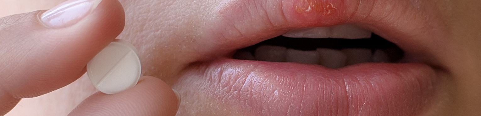 Acyklowir - działanie tabletek na opryszczkę