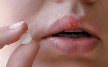 Acyklowir - działanie tabletek na opryszczkę